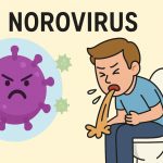 Norovirus: The “Winter Vomiting Bug”